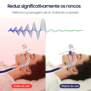 Micro-CPAP Eletrônico Portátil e Sem Fios IZESHOP