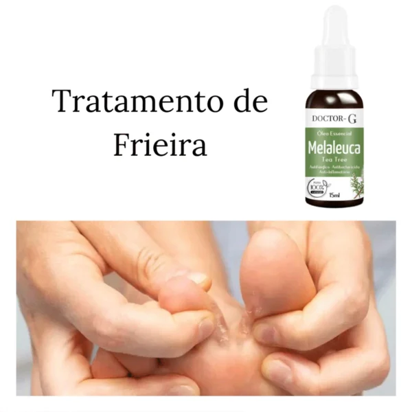 Óleo Essencial 100% Puro de Melaleuca Tea Tree 15ML IZENATURE PURE IZESHOP