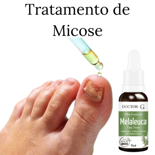 Óleo Essencial 100% Puro de Melaleuca Tea Tree 15ML IZENATURE PURE IZESHOP