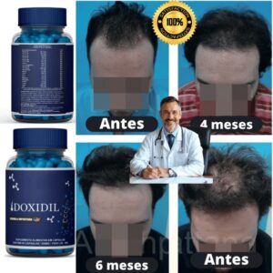 Vitamina Completa para Cabelo e Barba Fortalecimento Doxidil 60 Cápsulas IZESHOP