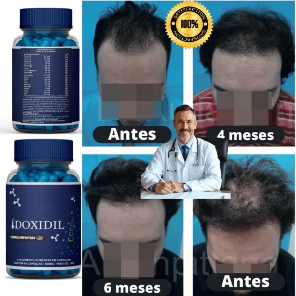 Vitamina Completa para Cabelo e Barba Fortalecimento Doxidil 60 Cápsulas IZESHOP