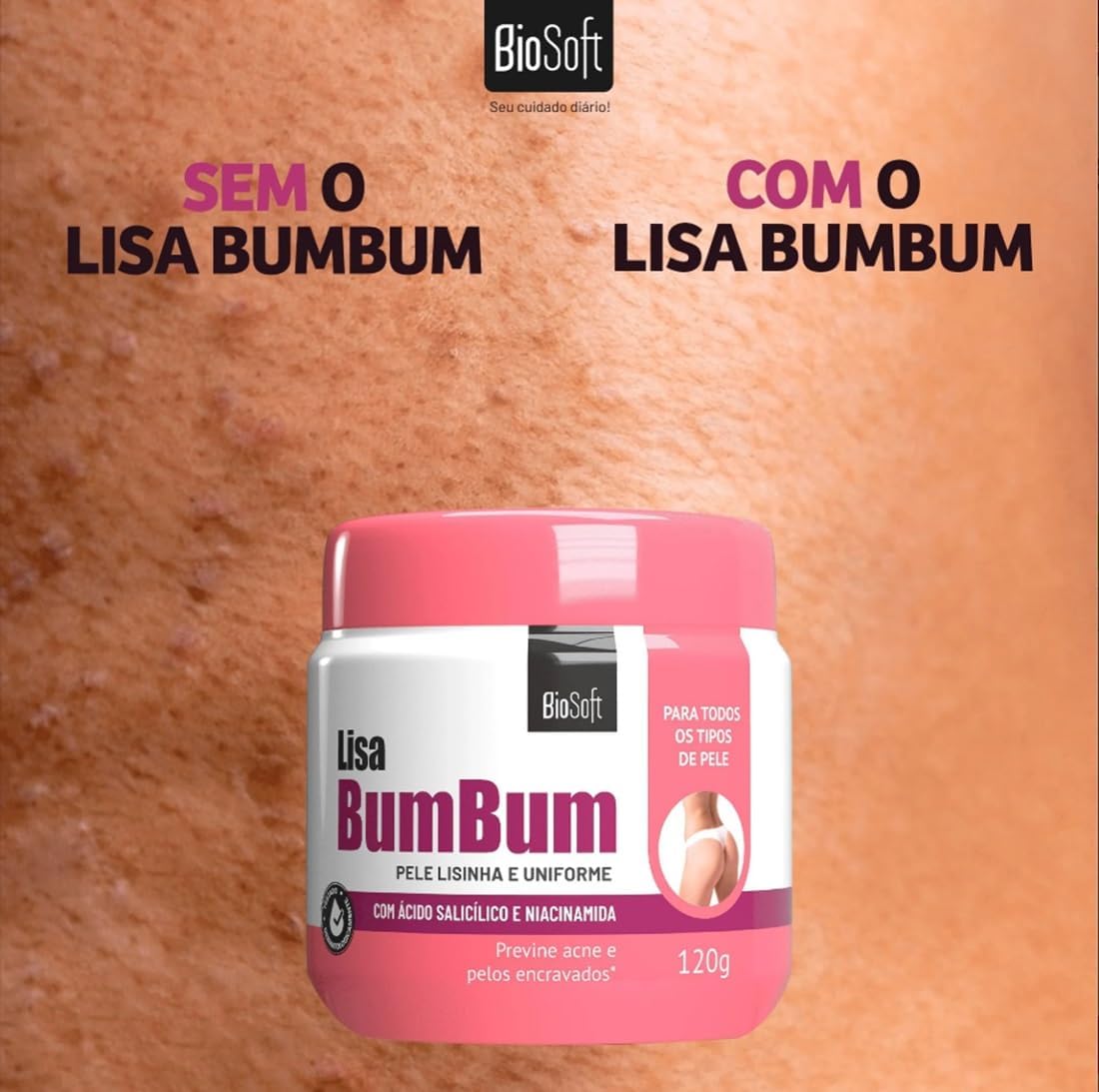 Creme Hidratante para Bumbum Bio Soft 120 g com Ácido Salicílico e Niacinamida, Renovação Celular e Hidratação IZECARE
